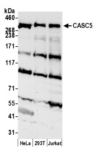 CASC5 Antibody in Western Blot (WB)