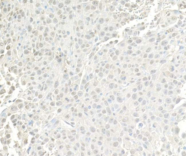 BRG1/SMARCA4 Antibody in Immunohistochemistry (Paraffin) (IHC (P))