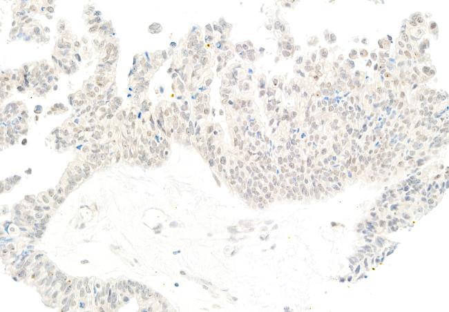 PIMT Antibody in Immunohistochemistry (Paraffin) (IHC (P))