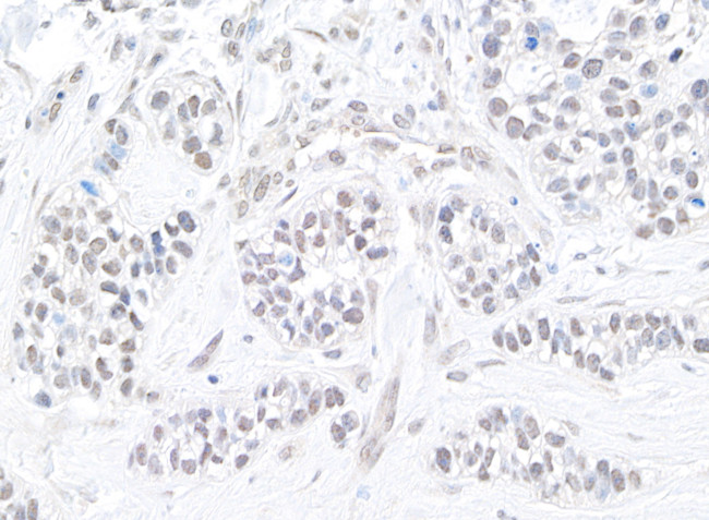 TIF1 Alpha/TRIM24 Antibody in Immunohistochemistry (Paraffin) (IHC (P))