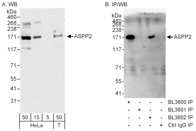 ASPP2 Antibody in Western Blot (WB)