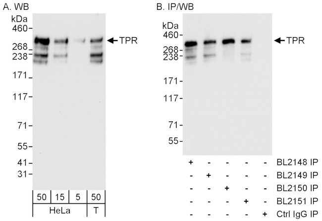 TPR Antibody in Western Blot (WB)