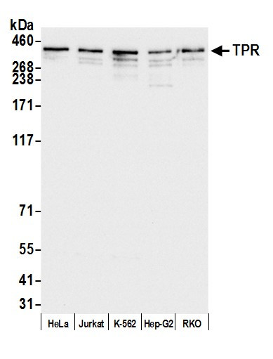 TPR Antibody in Western Blot (WB)