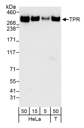 TPR Antibody in Western Blot (WB)