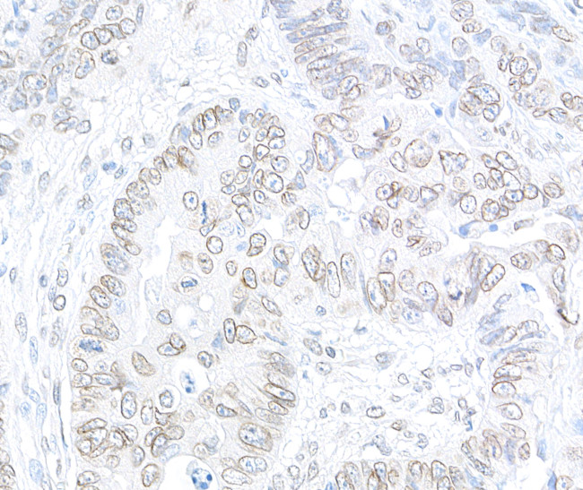 TPR Antibody in Immunohistochemistry (Paraffin) (IHC (P))