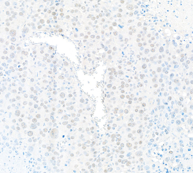 PPP4C Antibody in Immunohistochemistry (Paraffin) (IHC (P))