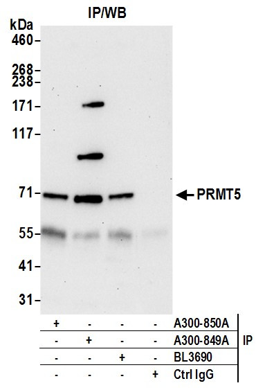 PRMT5 Antibody in Immunoprecipitation (IP)