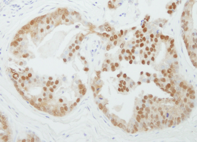 PRMT5 Antibody in Immunohistochemistry (Paraffin) (IHC (P))