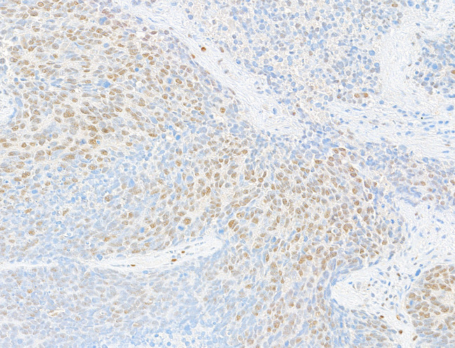 FOX2/RBM9 Antibody in Immunohistochemistry (Paraffin) (IHC (P))