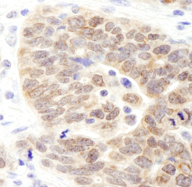 JMJD1B Antibody in Immunohistochemistry (Paraffin) (IHC (P))