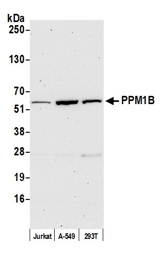 PPM1B Antibody in Western Blot (WB)