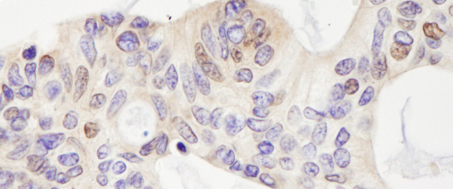 USP28 Antibody in Immunohistochemistry (Paraffin) (IHC (P))