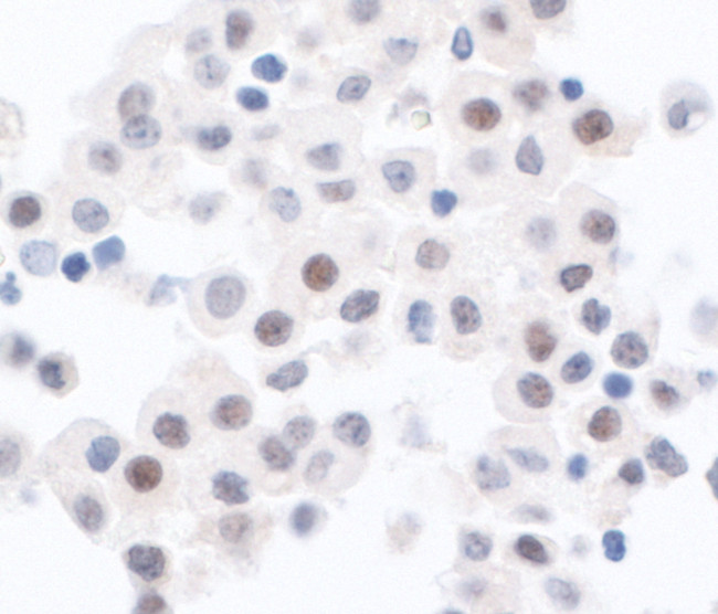 PPP1CA Antibody in Immunohistochemistry (Paraffin) (IHC (P))