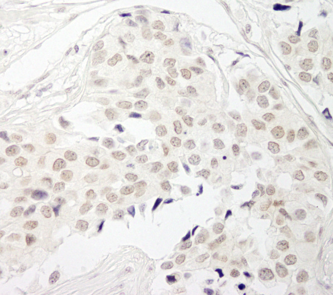 PPP1CB Antibody in Immunohistochemistry (Paraffin) (IHC (P))