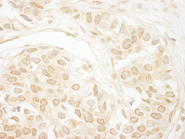 PPP3CA Antibody in Immunohistochemistry (Paraffin) (IHC (P))