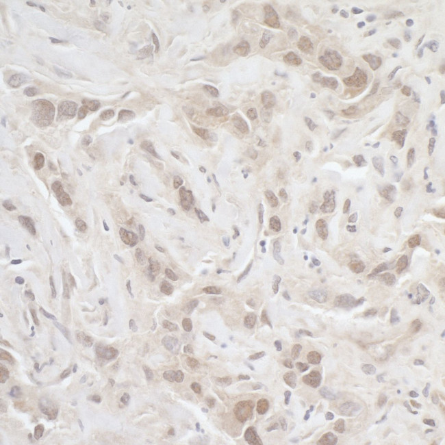 PPP3CA Antibody in Immunohistochemistry (Paraffin) (IHC (P))