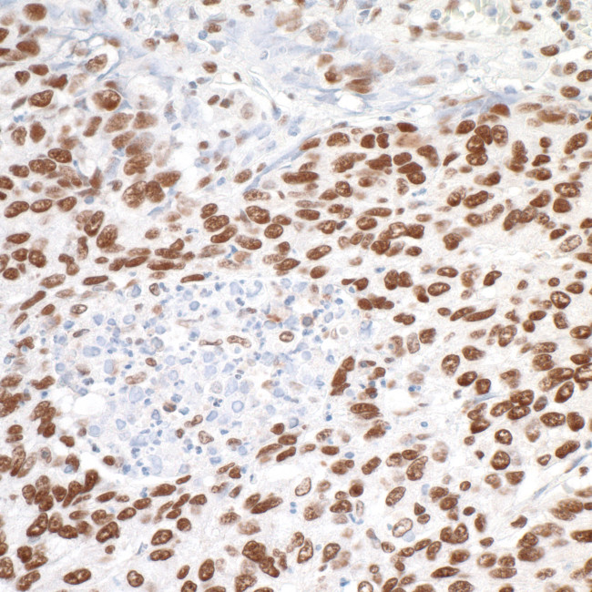 MTA1 Antibody in Immunohistochemistry (Paraffin) (IHC (P))