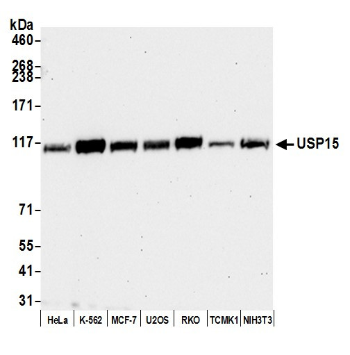 USP15 Antibody in Western Blot (WB)