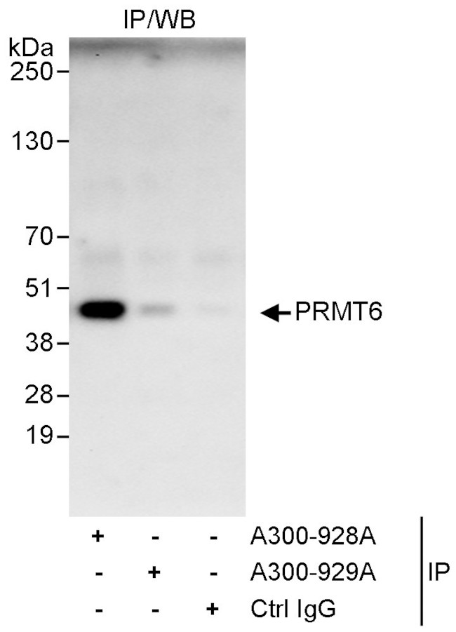 PRMT6 Antibody in Immunoprecipitation (IP)