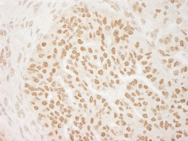 PRMT6 Antibody in Immunohistochemistry (Paraffin) (IHC (P))