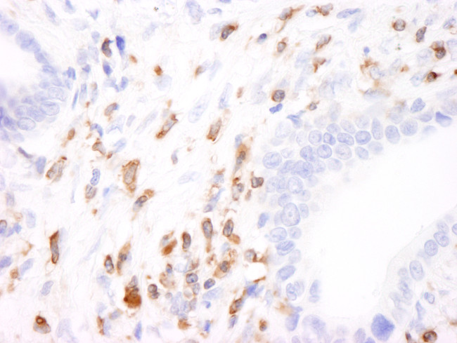 Coronin 1 Antibody in Immunohistochemistry (Paraffin) (IHC (P))