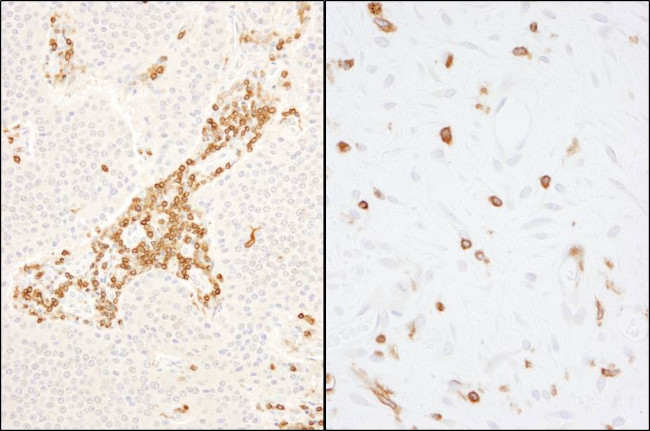 Coronin 1 Antibody in Immunohistochemistry (Paraffin) (IHC (P))