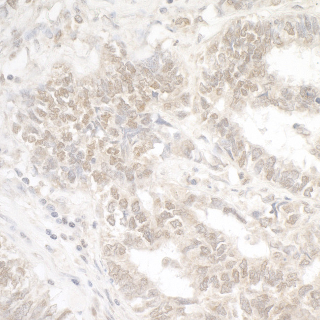 G9A/EHMT2 Antibody in Immunohistochemistry (Paraffin) (IHC (P))