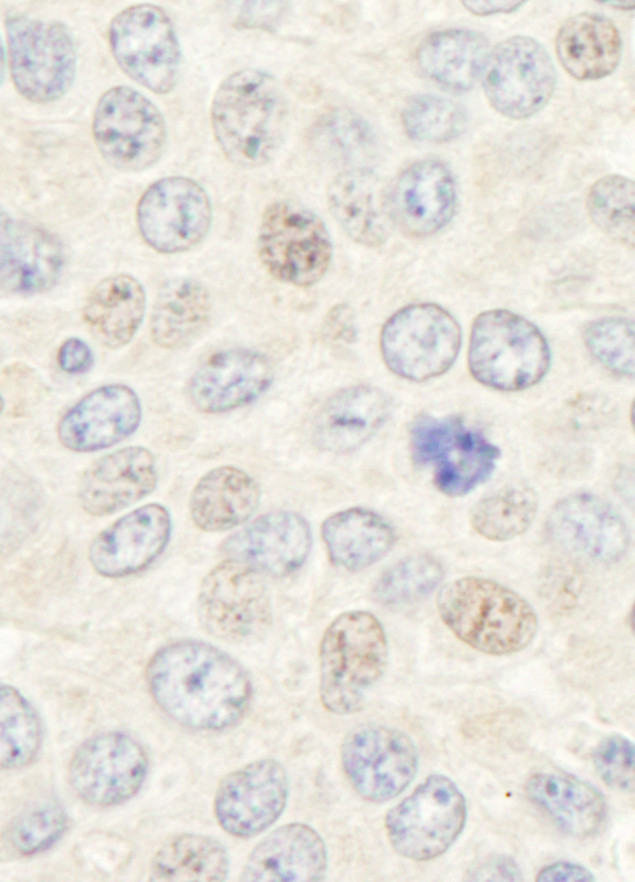 Geminin Antibody in Immunohistochemistry (Paraffin) (IHC (P))