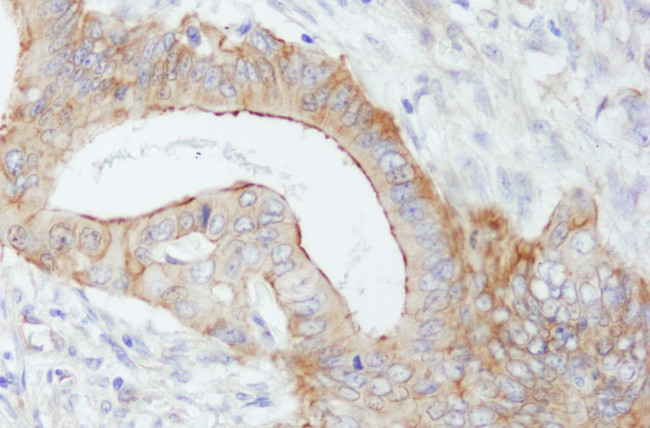 SPTBN1 Antibody in Immunohistochemistry (Paraffin) (IHC (P))