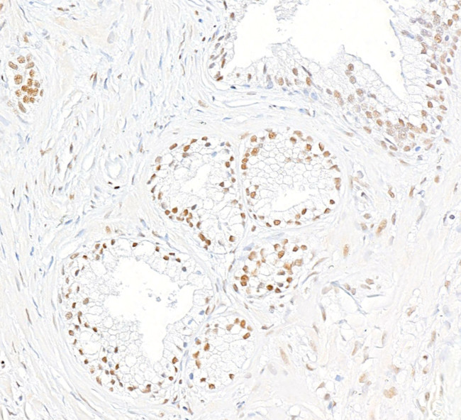 THRAP3/TRAP150 Antibody in Immunohistochemistry (Paraffin) (IHC (P))