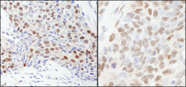 RbBP7 Antibody in Immunohistochemistry (Paraffin) (IHC (P))