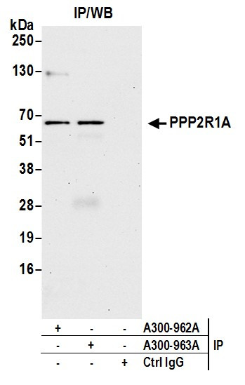 PPP2R1A Antibody in Immunoprecipitation (IP)