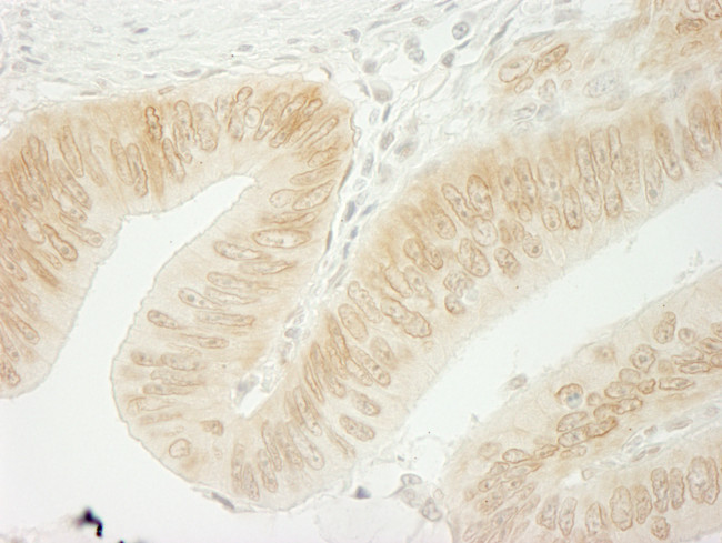 CTNND1 Antibody in Immunohistochemistry (Paraffin) (IHC (P))