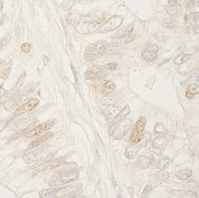 APC Antibody in Immunohistochemistry (Paraffin) (IHC (P))