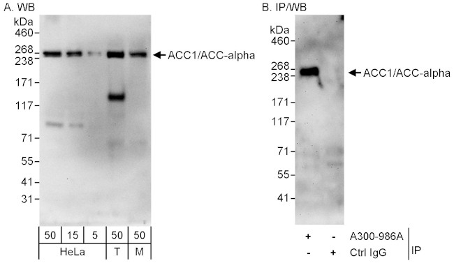 ACC1/ACC-alpha Antibody in Western Blot (WB)