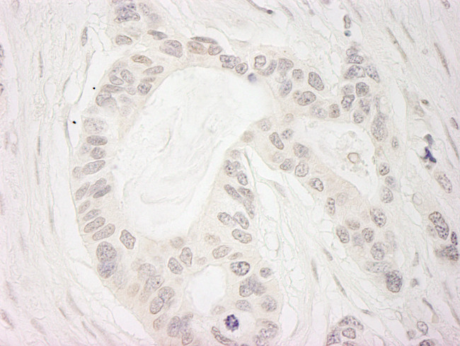 BubR1 Antibody in Immunohistochemistry (Paraffin) (IHC (P))