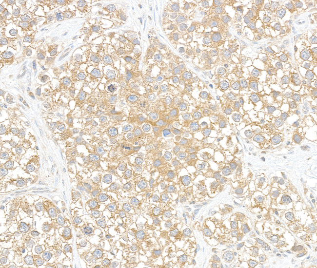 BIG1/ARFGEF1 Antibody in Immunohistochemistry (Paraffin) (IHC (P))