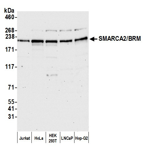 SMARCA2/BRM Antibody in Western Blot (WB)