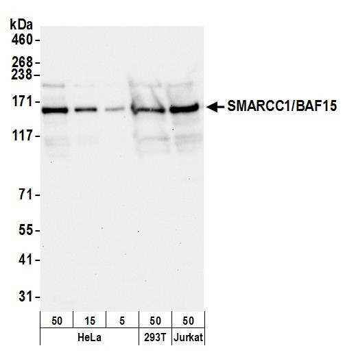 SMARCC1/BAF155 Antibody in Western Blot (WB)