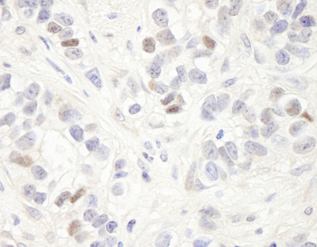 MAGED2 Antibody in Immunohistochemistry (Paraffin) (IHC (P))