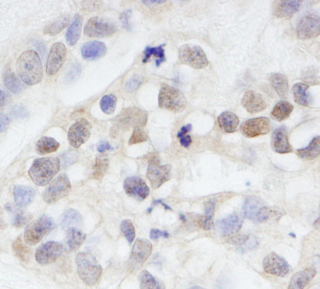 MAGED2 Antibody in Immunohistochemistry (Paraffin) (IHC (P))