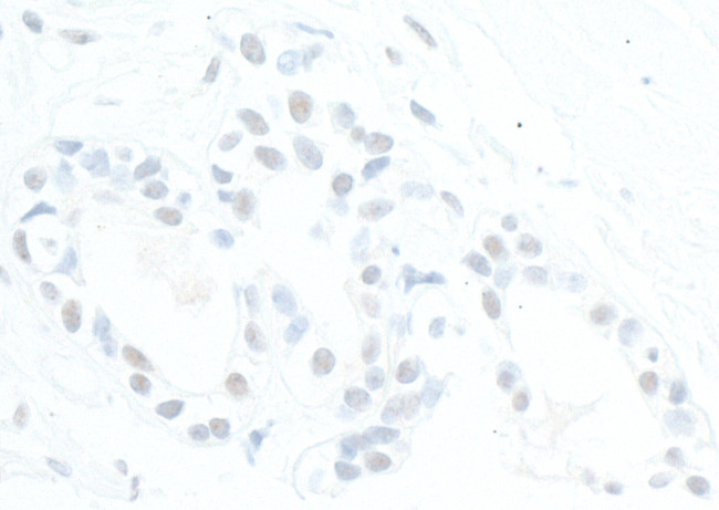 ATRX Antibody in Immunohistochemistry (Paraffin) (IHC (P))