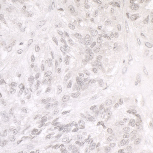 SMARCA1/SNF2L Antibody in Immunohistochemistry (Paraffin) (IHC (P))