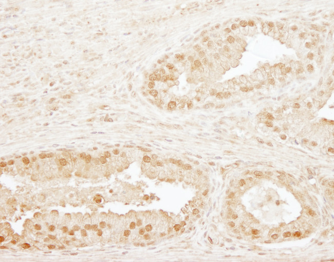 CPSF73 Antibody in Immunohistochemistry (Paraffin) (IHC (P))