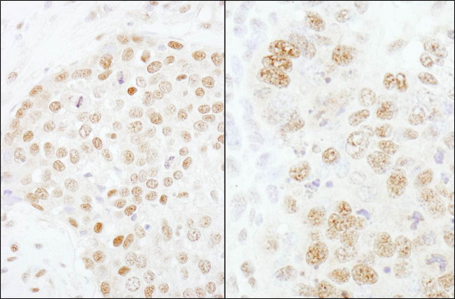 CPSF73 Antibody in Immunohistochemistry (Paraffin) (IHC (P))