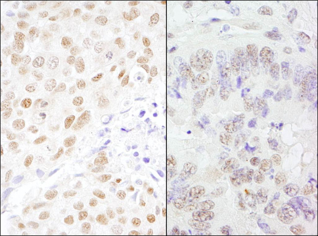 CSTF77 Antibody in Immunohistochemistry (Paraffin) (IHC (P))