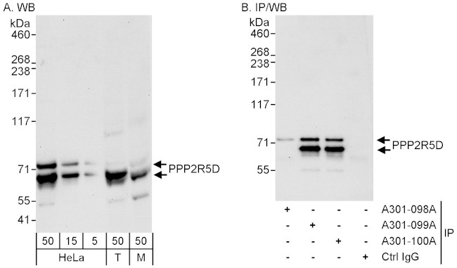 PPP2R5D Antibody in Western Blot (WB)