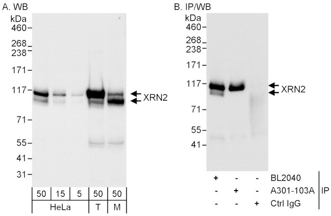 XRN2 Antibody in Western Blot (WB)