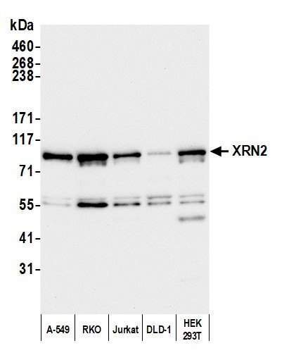 XRN2 Antibody in Western Blot (WB)