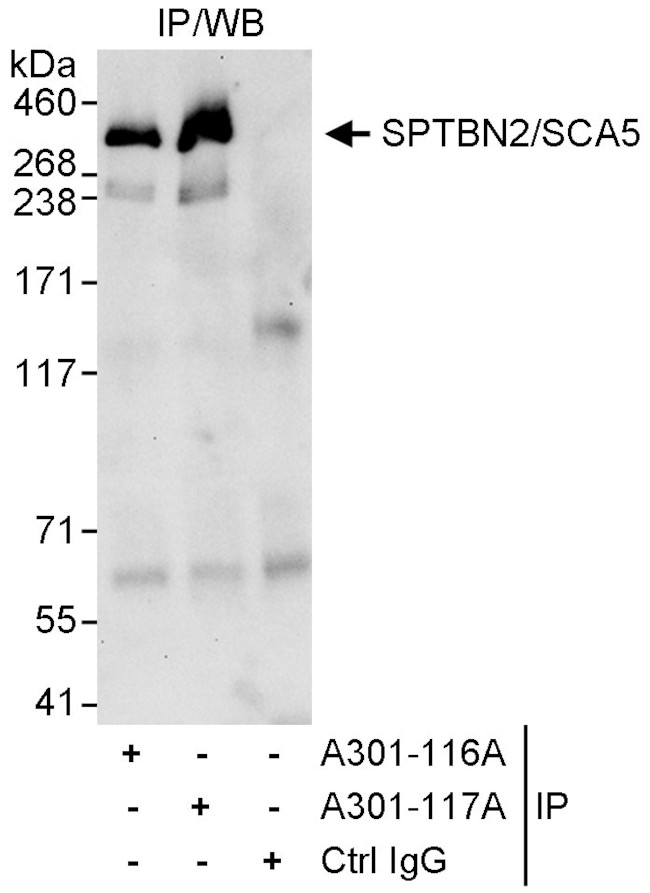 SPTBN2/SCA5 Antibody in Immunoprecipitation (IP)